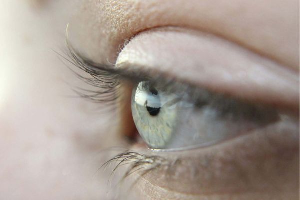 Myopia Control
