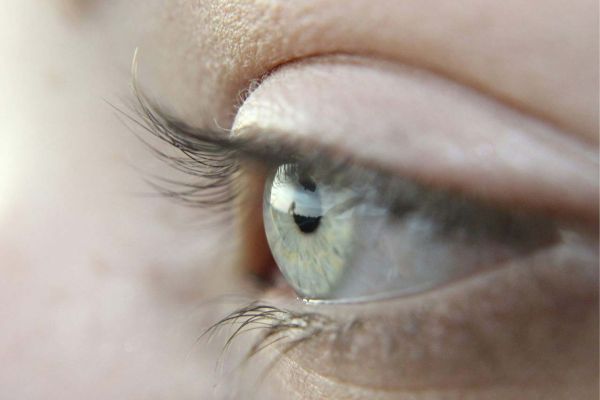 Myopia Control